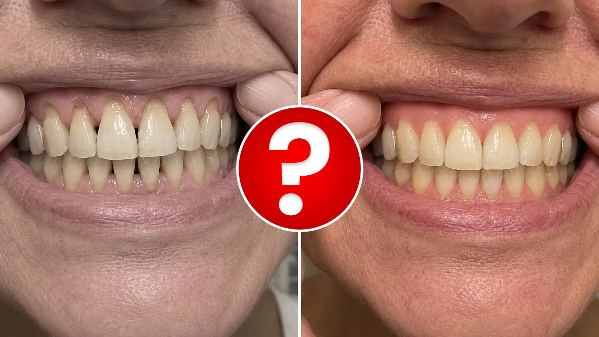 Can Receding Gums Really Grow Back? A New York Dermatologist Says Yes — And It Comes Down To One Thing Most Dentists Never Mention