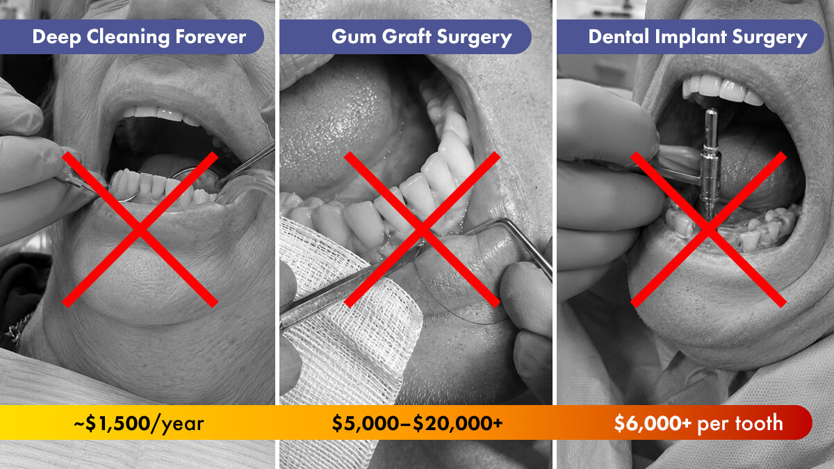 What Fixing Your Gums Really Costs in America