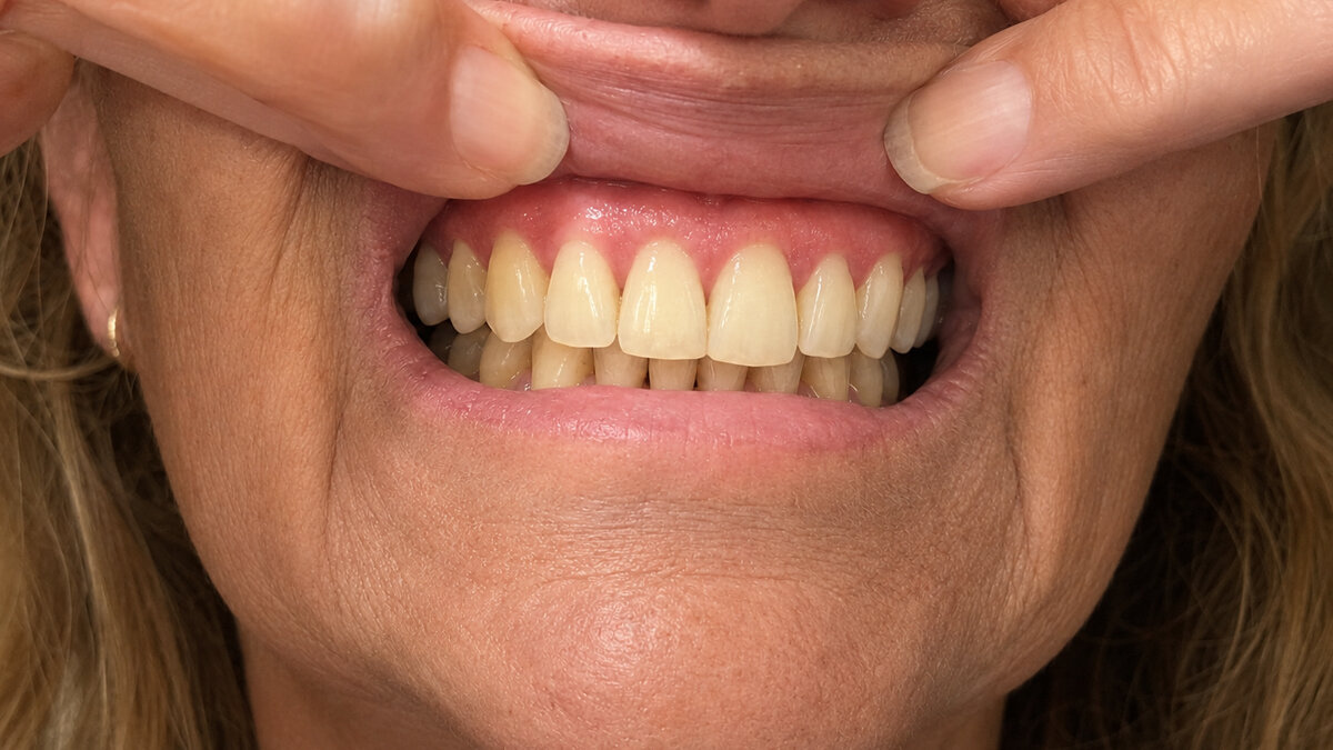 Day 60 · The before and after even I couldn’t believe